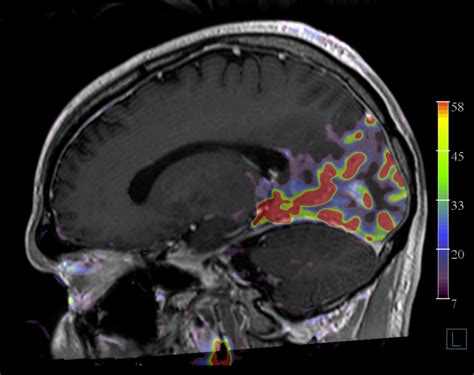 Image result for fMRI Python
