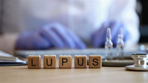 What Causes Lupus? Genes, Environment, and Triggers Explained