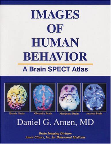 Buy Images of Human Behavior: A Brain SPECT Atlas Book Online at Low ...