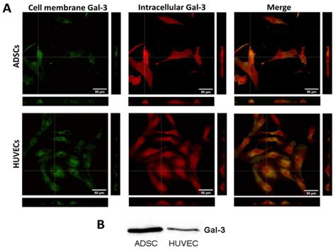 Interaction between Galectin-3 and Integrins Mediates Cell-Matrix ...