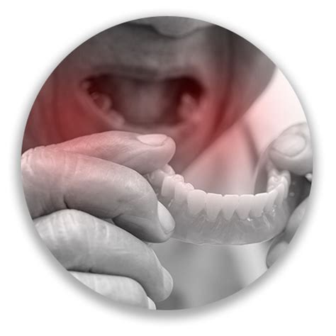 Orasore Mouth Ulcer Tablets & Gel | Complete Relief from Mouth Ulcers ...