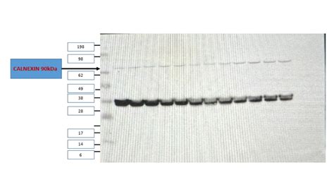 Calnexin antibody (10427-2-AP) | Proteintech