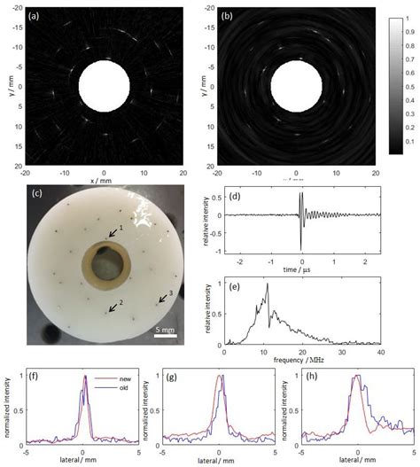 Advances in Photoacoustic Endoscopic Imaging Technology for Prostate ...