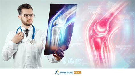 GLP-1 Drugs Ozempic, Mounjaro, Zepbound: A New Hope for Rheumatoid Arthritis? » Rheumatologist ...