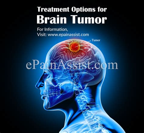 Brain Tumor|Types|Grades|Causes|Signs|Symptoms|Treatment
