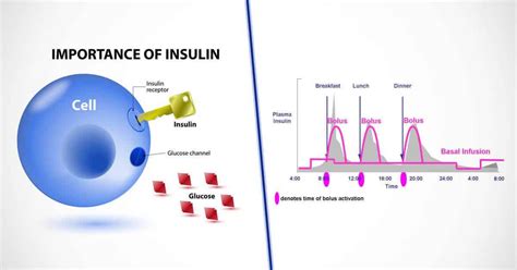 Image result for Insulin Management Algorithm