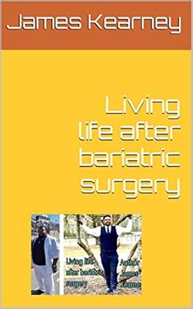 Living life after bariatric surgery eBook : Kearney, James: Amazon.in ...