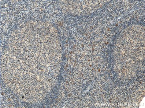 CD30/TNFRSF8 antibody (55132-1-AP) | Proteintech