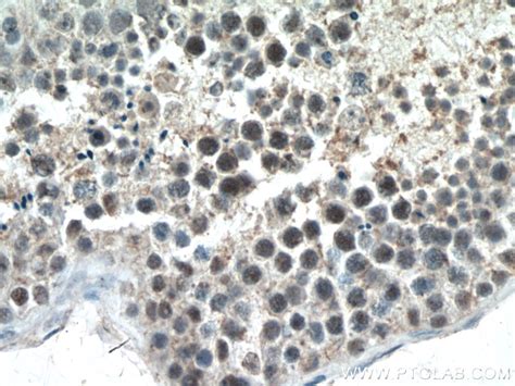UBR5 antibody (22782-1-AP) | Proteintech