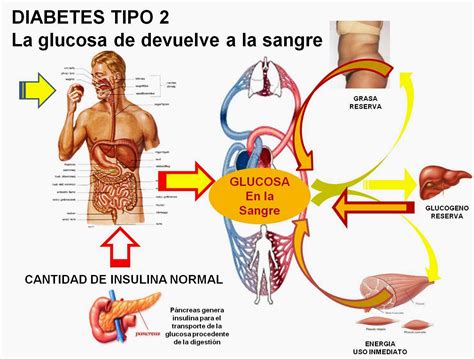 Diabetes Causas efectos y como controlarla: Que es la diabetes...?