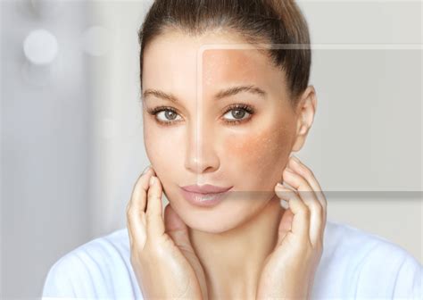 Understanding Different Skin Types and How to Care for Each – The Skin ...