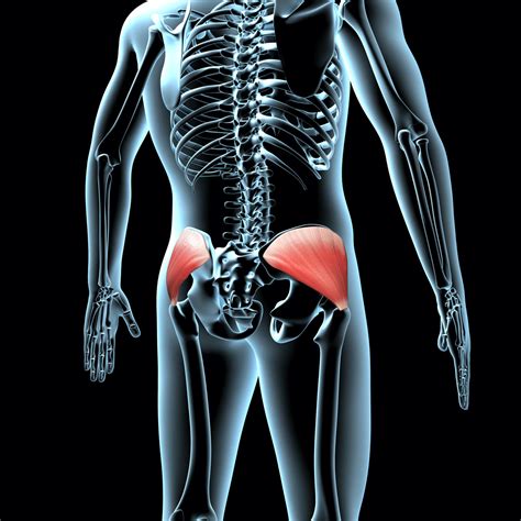 Gluteus Medius Trigger Points - Travell & Simons "Myofascial Pain and ...