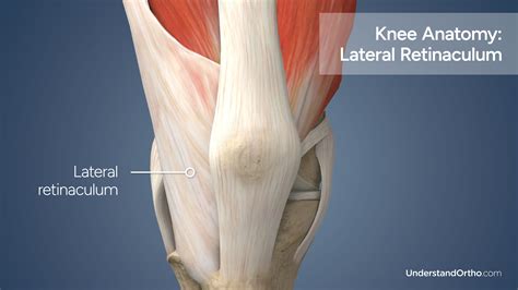 Patella Realignment – UnderstandOrtho™