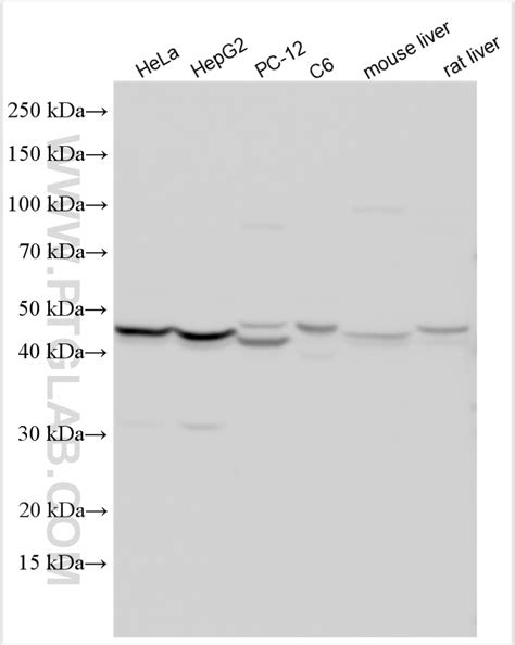 STEAP3 antibody (28478-1-AP) | Proteintech