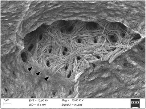 Ultrastructural Aspects of Physiological Mineralization: A Comparative ...