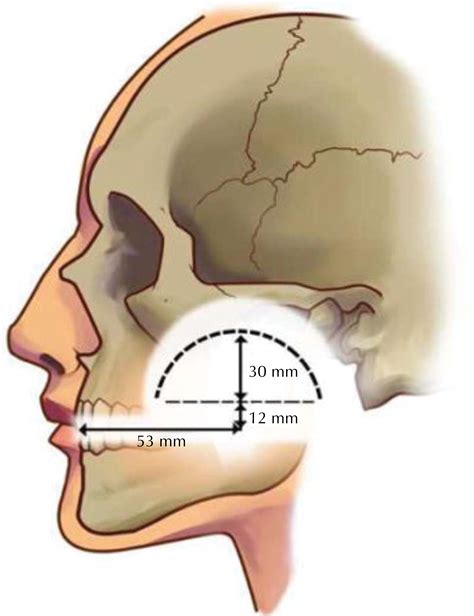 Buccal Fat Pad Anatomy