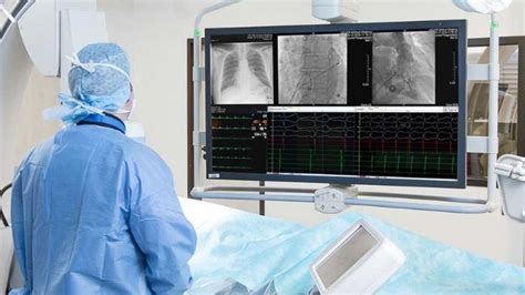 Managed equipment service (MES)