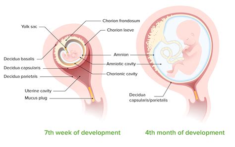 Prelabor Rupture of Membranes | Concise Medical Knowledge