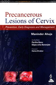 Precancerous Lesions of Cervix: Buy Precancerous Lesions of Cervix by ...