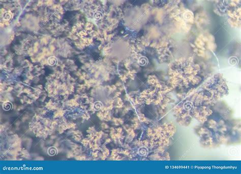 Bread Mold Under Microscope