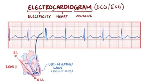 ECG Explained 的图像结果