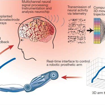 Rezultat imagine pentru BrainGate Systems