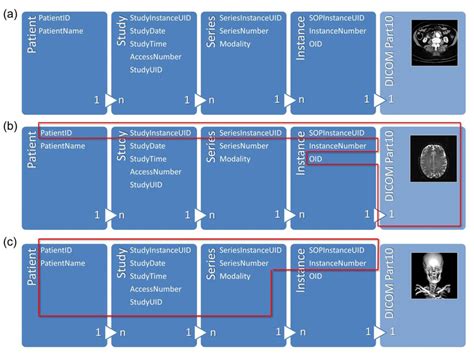 DICOM Query Retrieve Tool 的图像结果