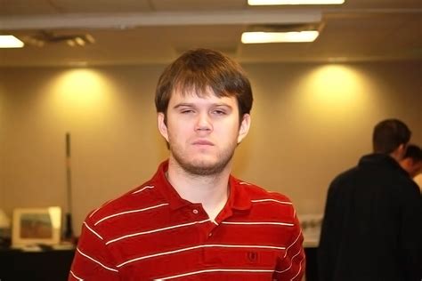 Fetal Alcohol Syndrome Adults Face