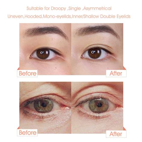 Why Are My Eyelids Sometimes Uneven at David Laramie blog