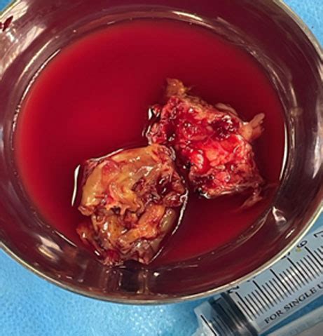 Government Medical College Thiruvallur