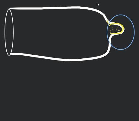 Image result for How Does a Condom Work