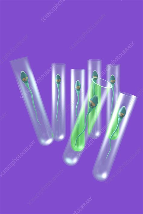 Image result for In Vitro Reproduction