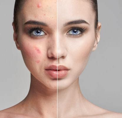 Best Dermatologist in Raipur, Skin Specialist in Raipur - Dr. Manoj ...