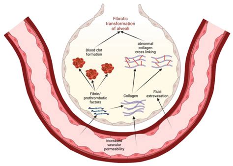 The Role of Sphingolipids in Regulating Vascular Permeability in ...