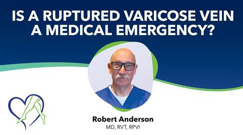 Center for Vein Restoration | Conozca las condiciones y tratamientos de las venas CVR Blog