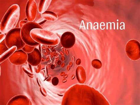 Iron-Deficiency Anemia: Warning Symptoms You Should Never Ignore ...