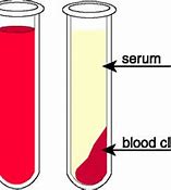 blood serum 的图像结果
