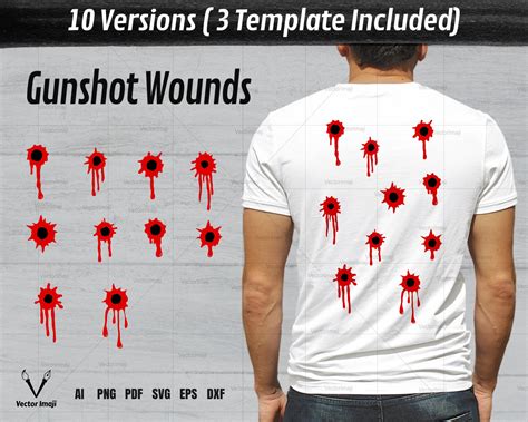 Gunshot Wounds