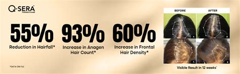 Buy QSERA Hair Growth Serum 20 Days Hair Fall Control Solution ...