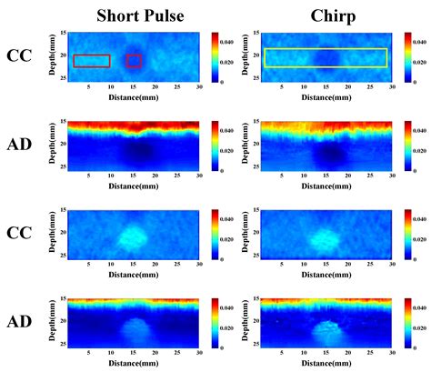 Ultrasound Elasticity Imaging System with Chirp-Coded Excitation for ...