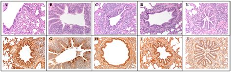 Experimental Efficacy of an Alphavirus Vectored RNA Particle Vaccine ...