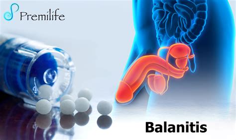 Topical Medication For Balanitis at Frank Jimenez blog