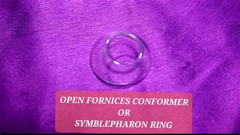 Auto Refractometer And Ophthalmic Refraction Equipment - Open Fornices ...