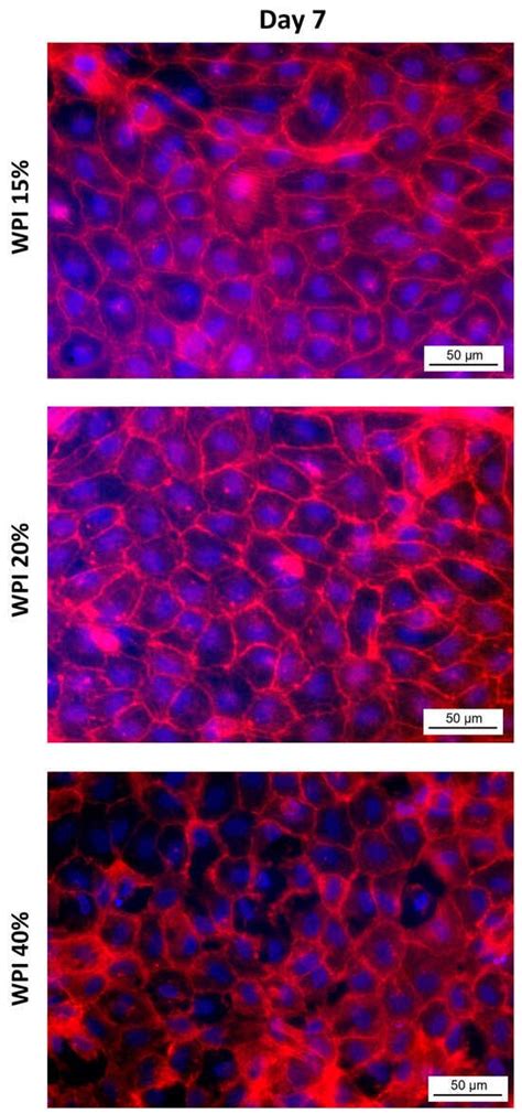 Endothelialization of Whey Protein Isolate-Based Scaffolds for Tissue ...