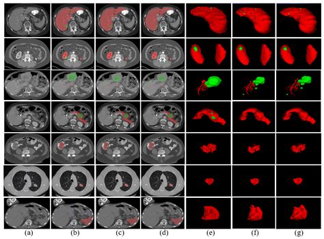 3D Multi-Organ and Tumor Segmentation Based on Re-Parameterize Diverse ...
