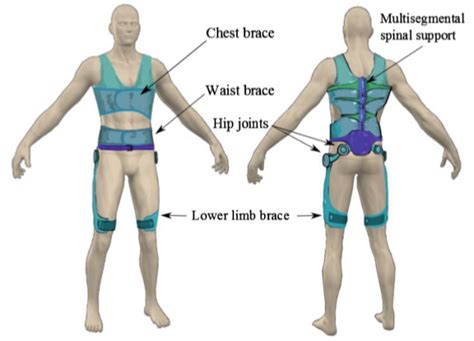 Review of Current Spinal Robotic Orthoses