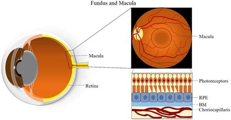 Age-Related Macular Degeneration (AMD) | Encyclopedia MDPI
