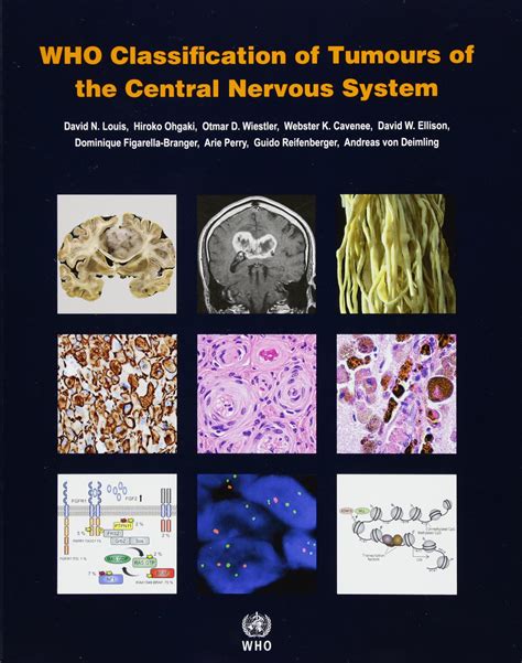 Buy WHO Classification of Tumours of the Central Nervous System [OP ...