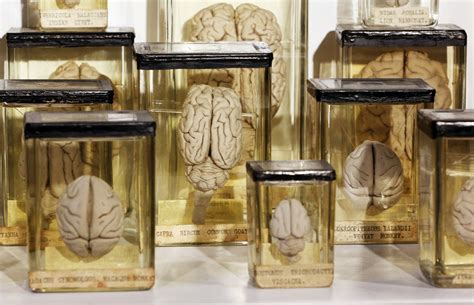 Image result for Brain Tissue Sample