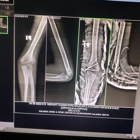 Nalanda Bone & Spine Centre | Homepage